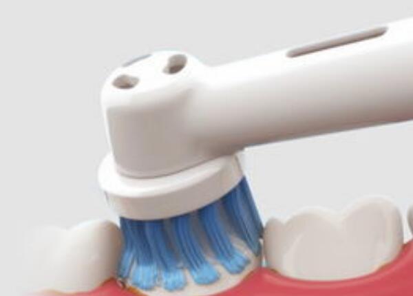 電動(dòng)牙刷使用 電動(dòng)牙刷傷牙齒