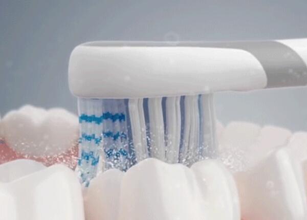 用洗牙器好還是電動牙刷 用洗牙器好還是電動牙刷