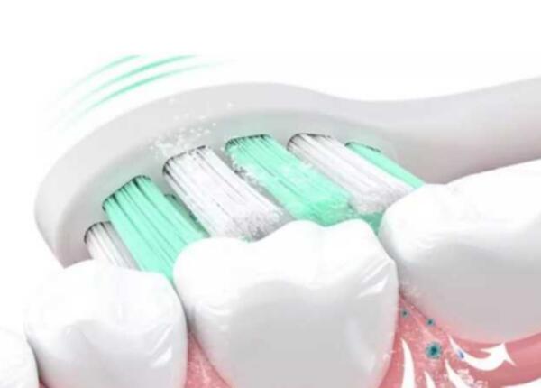 電動牙刷選購指南 電動牙刷選購指南